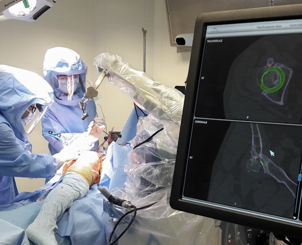 chirurgia mini invasiva, chirurgia robotica ortopedica, chirurgia protesica robotica articolare, caldora group